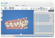 治療後のイメージが明確にわかる専用3Dシミュレーション